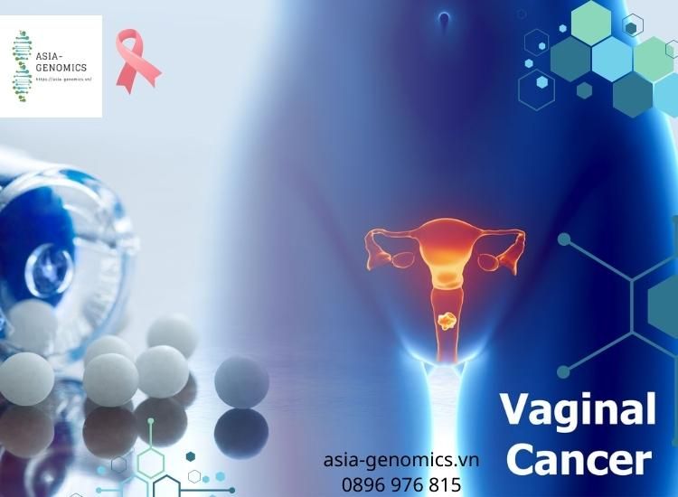 Tổng hợp thuốc và hoạt chất điều trị Ung thư Âm Đạo