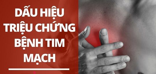 Những dấu hiệu triệu chứng tim mạch cần được điều trị ngay