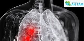 Thuốc nhắm trúng đích trong điều trị ung thư phổi